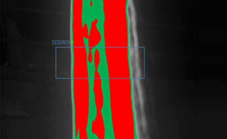Slag Detection in Copper Smelting Operations