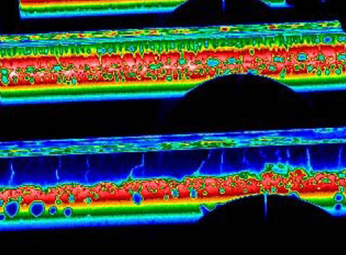NIR-656 & NIR-2K Profile Thermal Image 1